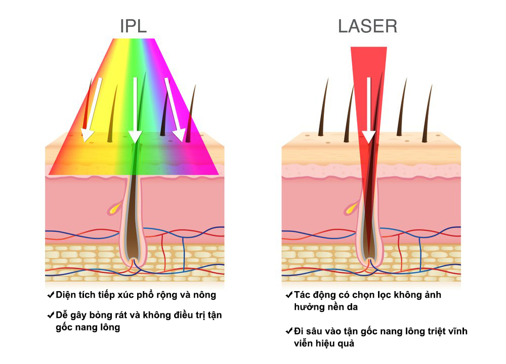 triet long piconano e light shr